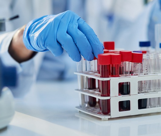 Αιματολογικό