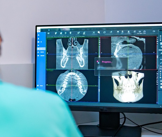 Ψηφιακή Πανοραμική – Dental Scan – CBCT