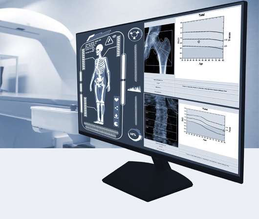 Μέτρηση Οστικής Πυκνότητας